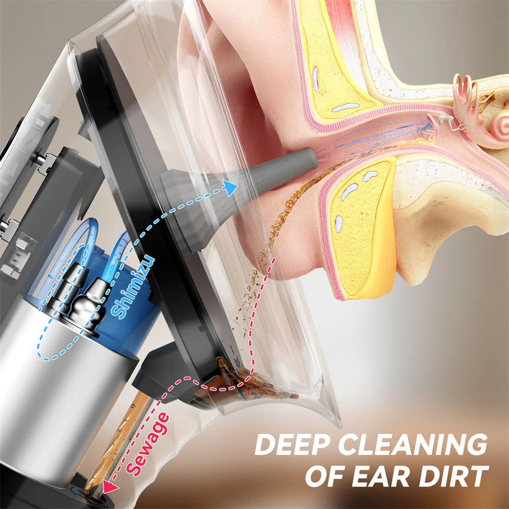 ClearFlow Gentle Ear Irrigator Pro